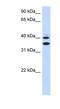 Solute Carrier Family 25 Member 32 antibody, NBP1-59566, Novus Biologicals, Western Blot image 
