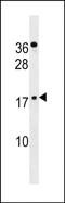 Zinc finger protein 663 antibody, PA5-72123, Invitrogen Antibodies, Western Blot image 