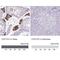 Cytochrome P450 Family 17 Subfamily A Member 1 antibody, NBP2-13892, Novus Biologicals, Immunohistochemistry paraffin image 