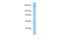 Ankyrin Repeat Domain 50 antibody, A13606, Boster Biological Technology, Western Blot image 