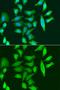 Calcitonin Related Polypeptide Alpha antibody, orb167412, Biorbyt, Immunocytochemistry image 