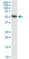 Amylase Alpha 1C (Salivary) antibody, H00000276-M04, Novus Biologicals, Western Blot image 