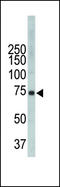 Tyrosine-protein kinase ITK/TSK antibody, LS-C99381, Lifespan Biosciences, Western Blot image 