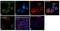 Histone Deacetylase 5 antibody, PA5-38116, Invitrogen Antibodies, Immunofluorescence image 