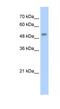 5'-Aminolevulinate Synthase 2 antibody, NBP1-54728, Novus Biologicals, Western Blot image 