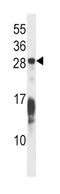 RAP1B, Member Of RAS Oncogene Family antibody, abx028359, Abbexa, Western Blot image 