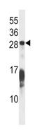 Ras-related protein Rap-1b antibody, abx028359, Abbexa, Western Blot image 