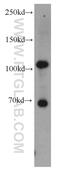 Hexokinase 2 antibody, 22029-1-AP, Proteintech Group, Western Blot image 