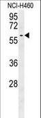 Dynein Cytoplasmic 1 Light Intermediate Chain 2 antibody, LS-C167589, Lifespan Biosciences, Western Blot image 