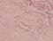 ATP Binding Cassette Subfamily B Member 1 antibody, A00049-2, Boster Biological Technology, Immunohistochemistry frozen image 