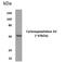 Carboxypeptidase A2 antibody, GTX52573, GeneTex, Western Blot image 