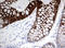 Keratin 20 antibody, LS-C336591, Lifespan Biosciences, Immunohistochemistry paraffin image 