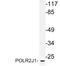 DNA-directed RNA polymerase II subunit RPB11 antibody, LS-C177828, Lifespan Biosciences, Western Blot image 