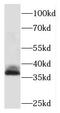 Paired Like Homeobox 2A antibody, FNab06407, FineTest, Western Blot image 