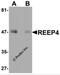 Receptor Accessory Protein 4 antibody, 5575, ProSci, Western Blot image 