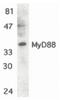 MYD88 Innate Immune Signal Transduction Adaptor antibody, PA5-19919, Invitrogen Antibodies, Western Blot image 