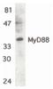 MYD88 Innate Immune Signal Transduction Adaptor antibody, PA5-19919, Invitrogen Antibodies, Western Blot image 