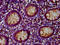 Patatin Like Phospholipase Domain Containing 5 antibody, CSB-PA773803LA01HU, Cusabio, Immunohistochemistry paraffin image 