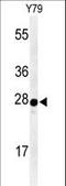 Serotonin acetylase antibody, LS-C155833, Lifespan Biosciences, Western Blot image 