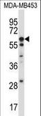 Uromodulin antibody, LS-B9021, Lifespan Biosciences, Western Blot image 