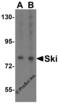 Ski oncogene antibody, 2259, ProSci, Western Blot image 