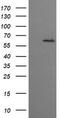 Chaperonin Containing TCP1 Subunit 8 Like 2 antibody, M16124-1, Boster Biological Technology, Western Blot image 
