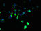 Abhydrolase Domain Containing 2 antibody, LS-C375101, Lifespan Biosciences, Immunofluorescence image 