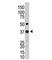 Ubiquitin C-Terminal Hydrolase L5 antibody, F47955-0.4ML, NSJ Bioreagents, Western Blot image 