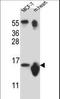 Small Nuclear Ribonucleoprotein D3 Polypeptide antibody, LS-B13765, Lifespan Biosciences, Western Blot image 