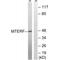 Mitochondrial transcription termination factor 1 antibody, A08459, Boster Biological Technology, Western Blot image 