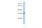 Survival Motor Neuron Domain Containing 1 antibody, PA5-69088, Invitrogen Antibodies, Western Blot image 