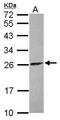 ATP Synthase Peripheral Stalk-Membrane Subunit B antibody, GTX114970, GeneTex, Western Blot image 