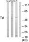 ETS Variant 6 antibody, TA313850, Origene, Western Blot image 