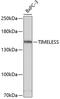 Timeless Circadian Regulator antibody, 19-320, ProSci, Western Blot image 