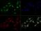 MRE11 Homolog, Double Strand Break Repair Nuclease antibody, GTX30294, GeneTex, Immunofluorescence image 