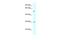 Amylase Alpha 2B (Pancreatic) antibody, A09355, Boster Biological Technology, Western Blot image 