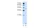 Solute Carrier Family 46 Member 3 antibody, A15198-1, Boster Biological Technology, Western Blot image 