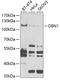 Drebrin 1 antibody, 22-162, ProSci, Western Blot image 