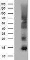 Follicle Stimulating Hormone Subunit Beta antibody, CF501602, Origene, Western Blot image 