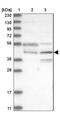 RNA Pseudouridine Synthase D3 antibody, NBP1-81135, Novus Biologicals, Western Blot image 
