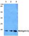 Checkpoint Kinase 2 antibody, A00277T432, Boster Biological Technology, Western Blot image 