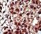 Diacylglycerol Kinase Iota antibody, PA5-15408, Invitrogen Antibodies, Immunohistochemistry paraffin image 