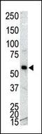 Calcium/Calmodulin Dependent Protein Kinase IG antibody, MBS9215257, MyBioSource, Western Blot image 