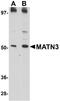 Matrilin 3 antibody, NBP1-77017, Novus Biologicals, Western Blot image 