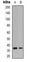 Cyclin Dependent Kinase 4 antibody, orb339109, Biorbyt, Western Blot image 