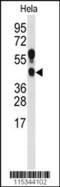 Protein Arginine Methyltransferase 1 antibody, MBS9210945, MyBioSource, Western Blot image 