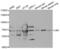 Lamin B Receptor antibody, abx004188, Abbexa, Western Blot image 