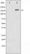 Erb-B2 Receptor Tyrosine Kinase 4 antibody, abx011657, Abbexa, Western Blot image 