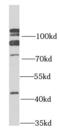 Smoothened, Frizzled Class Receptor antibody, FNab08037, FineTest, Western Blot image 