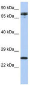 HNF1 Homeobox A antibody, TA339211, Origene, Western Blot image 